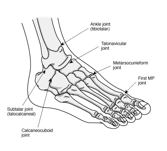 Arthritis of the Foot and Ankle - OrthoInfo - AAOS