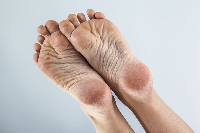 middle top of foot pain when walking
